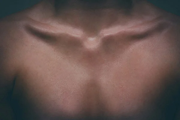 Aging Chest Treatments