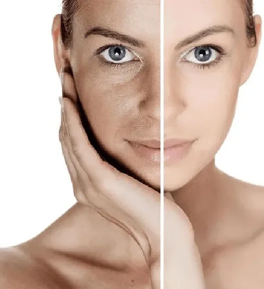 Dull Skin