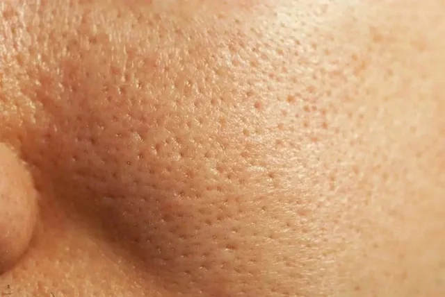 Large Pores Condition