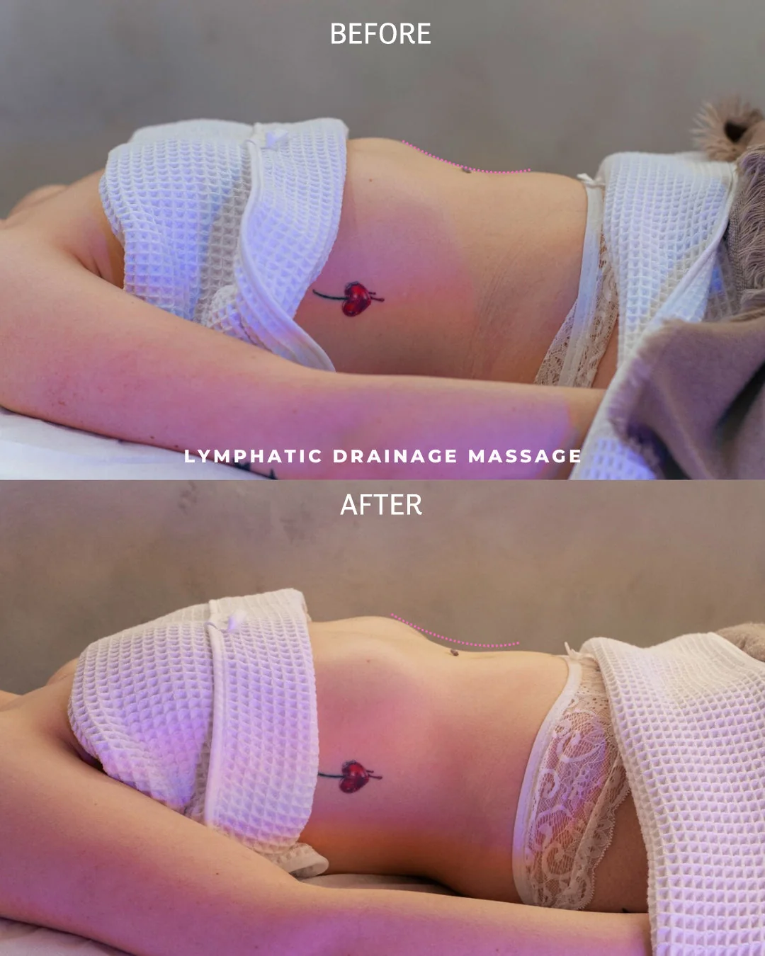 Lymphatic Drainage Massage