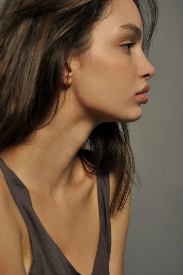 Non-Surgical Rhinoplasty