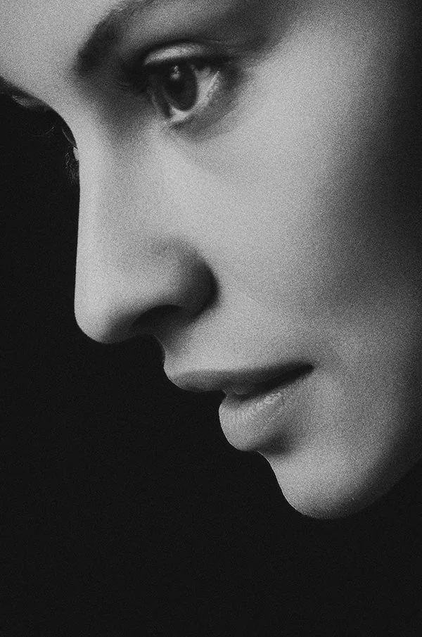 Non Surgical Rhinoplasty
