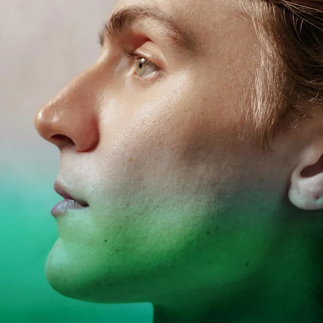 Microneedling