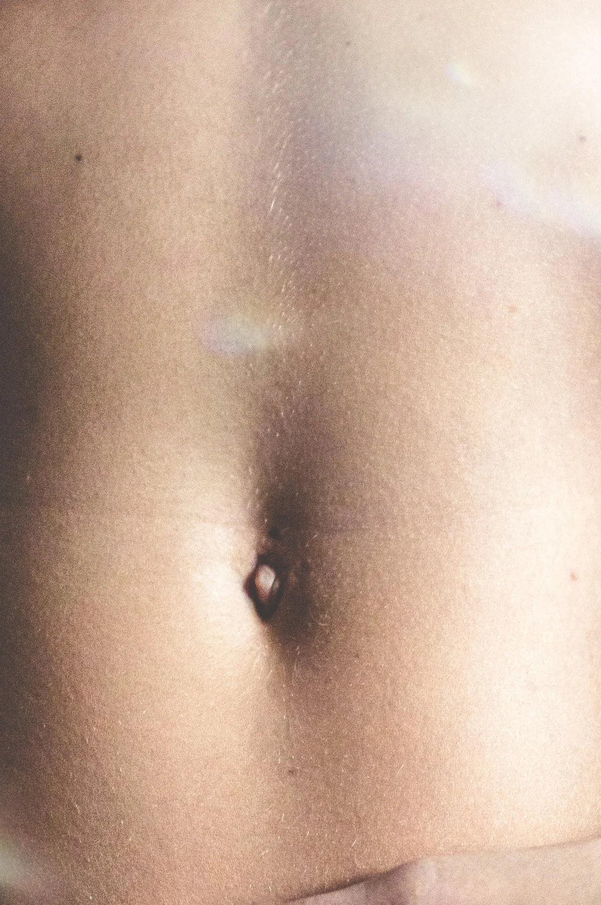 Thermage Body