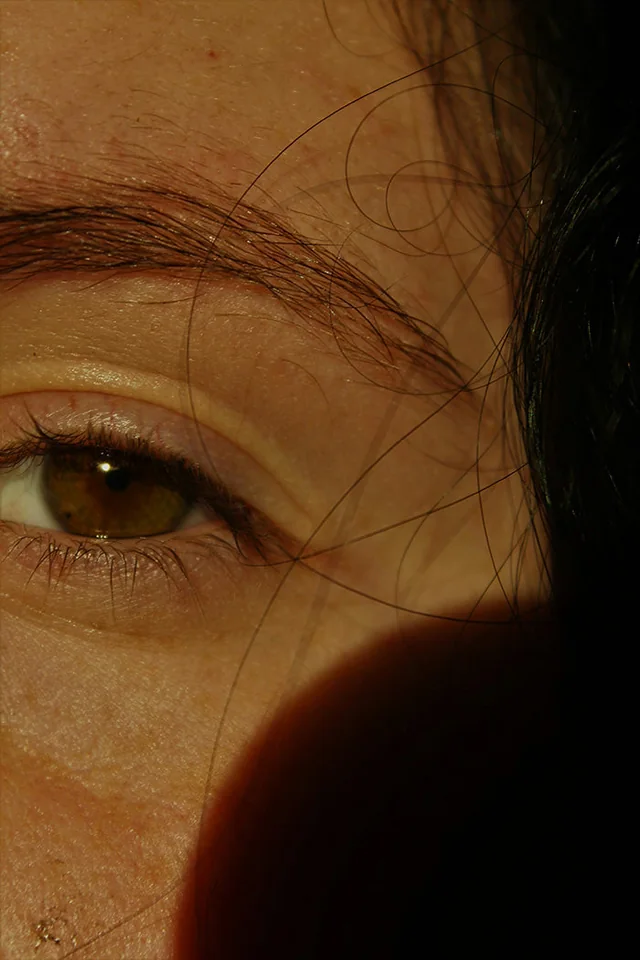 Dark Circle Treatment - Under Eyes